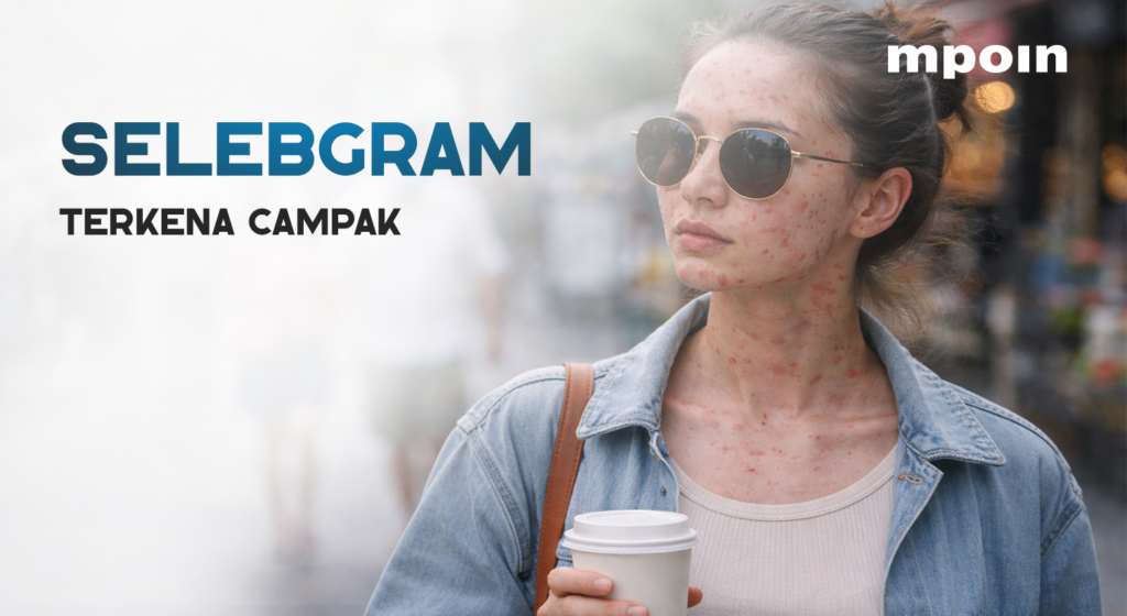 Bahaya Campak: Mengapa Penderita Tidak Boleh Keluar Rumah - MPOIN