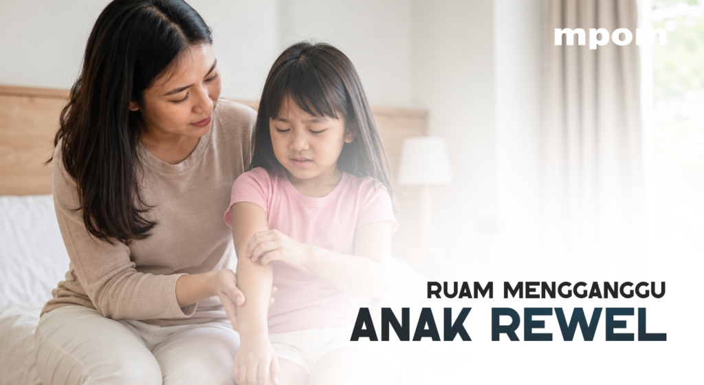 Anak Sering Rewel karena Ruam? Perhatikan 5 Hal Ini!